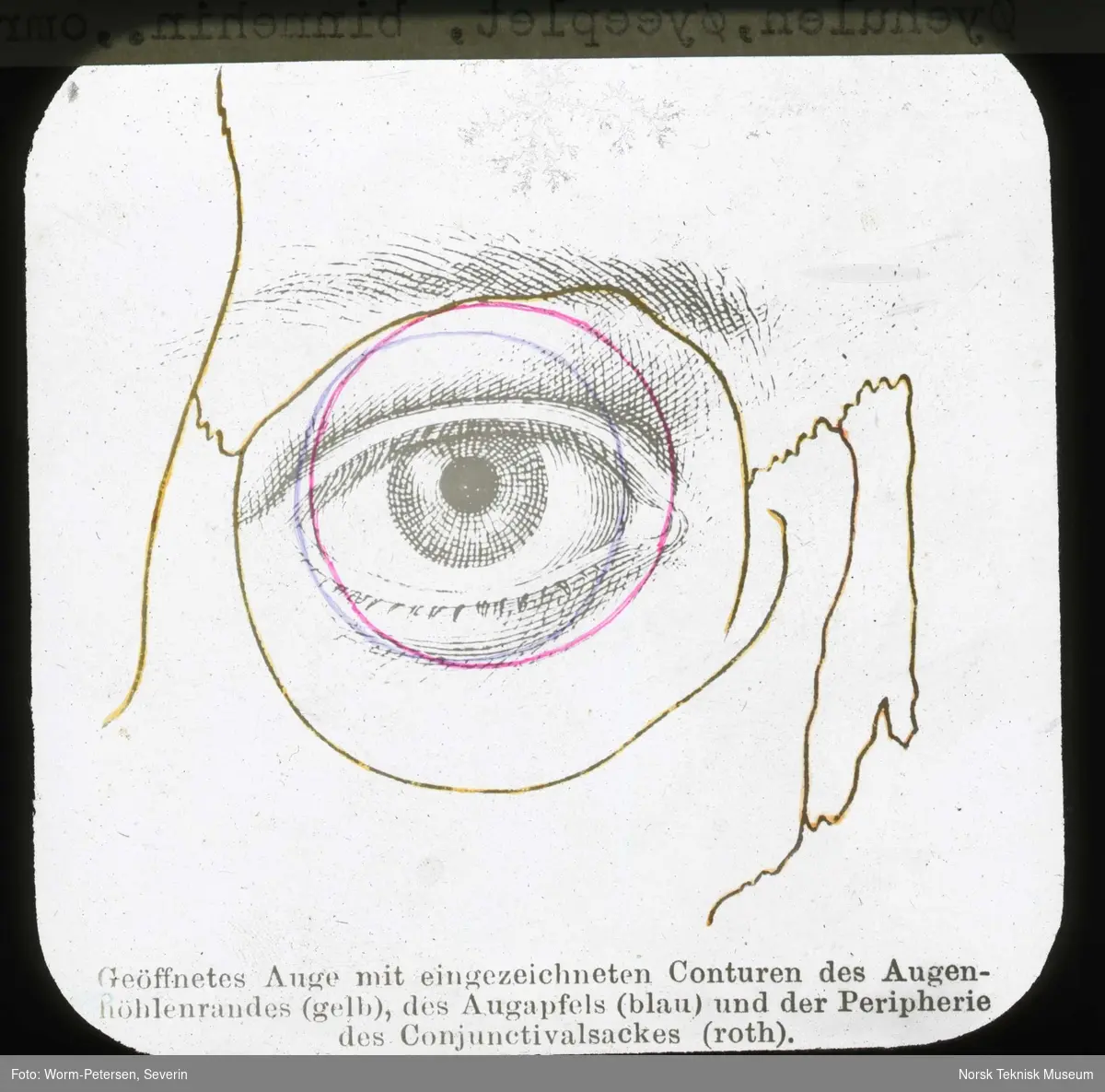 Anatomi; Øyet. Øyehulen, øyeeplet, binnehinne, omriss.