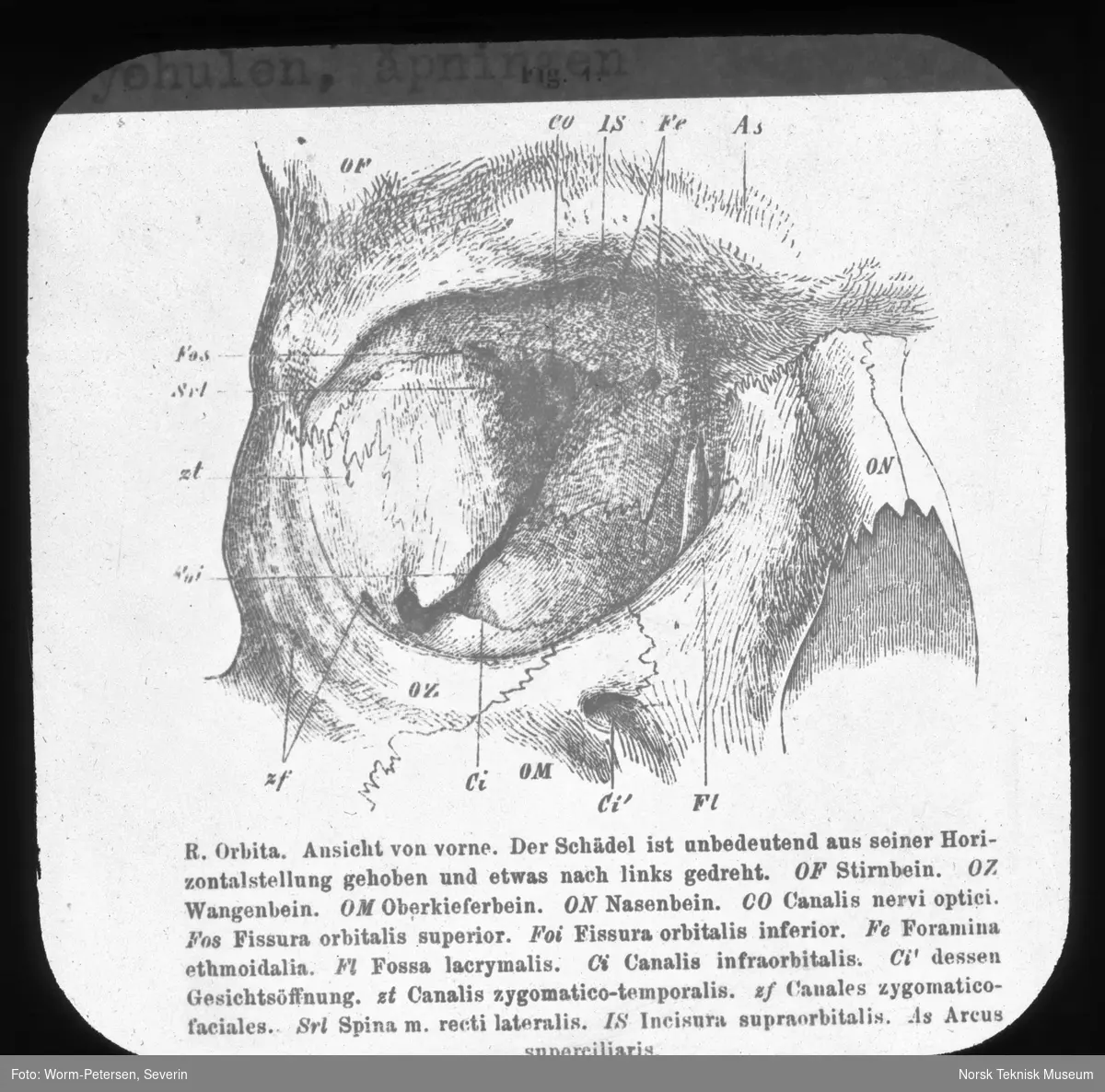 Anatomi; Øyet. Øyehulen, åpningen.