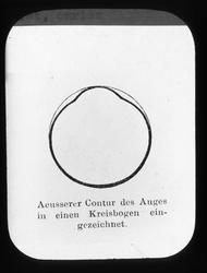 Anatomi; Øyet. Øyeeplet, omriss.
