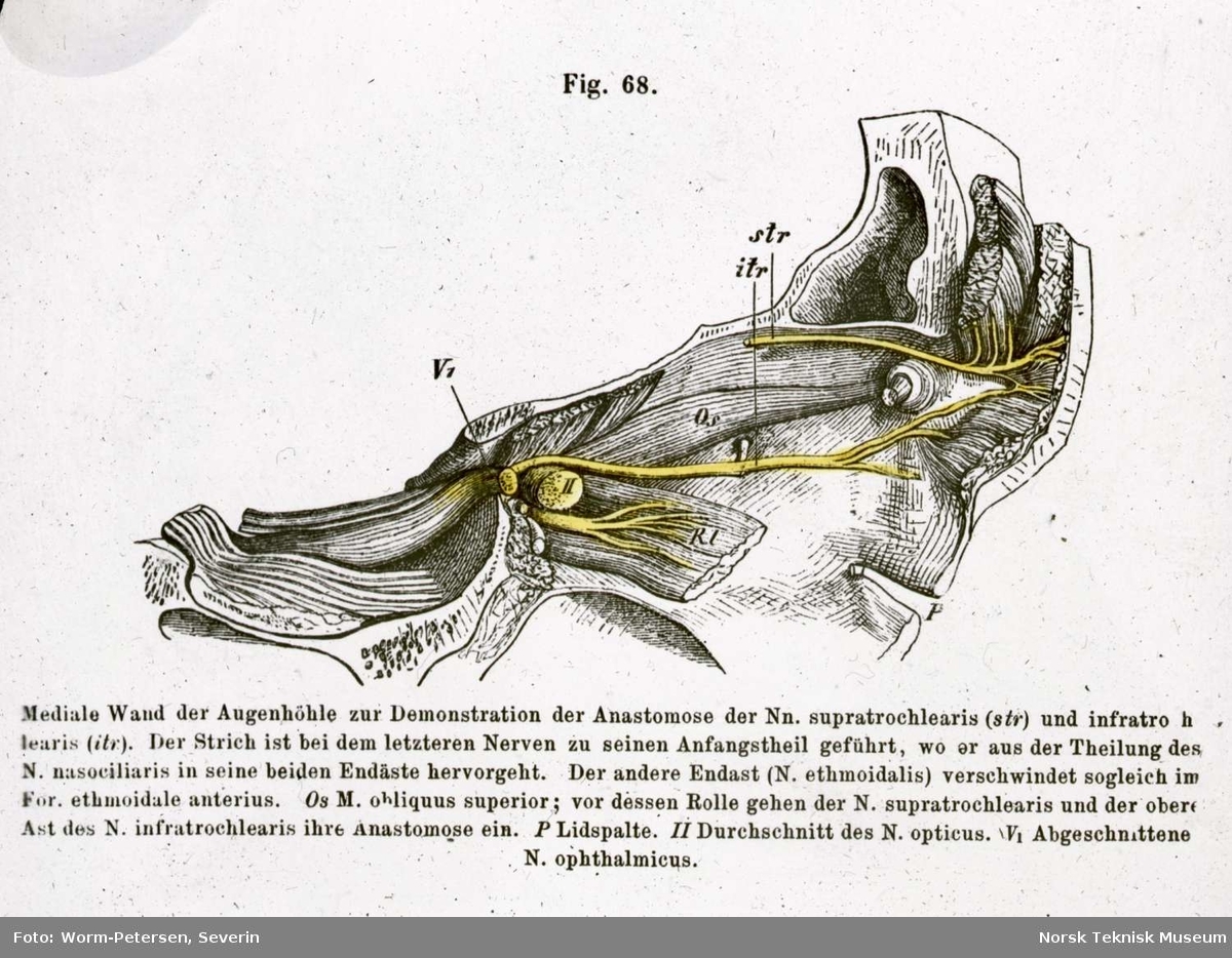 Kolorert anatomisk tegning av øyets anatomi. Avfotografert fra tysk illustrasjon.